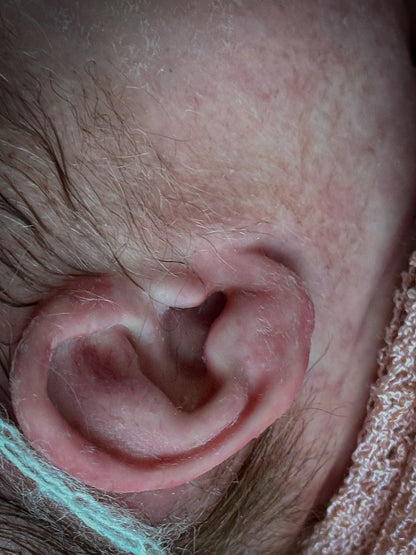 Custom Partial Silicone - Alyssa by Bountiful Baby