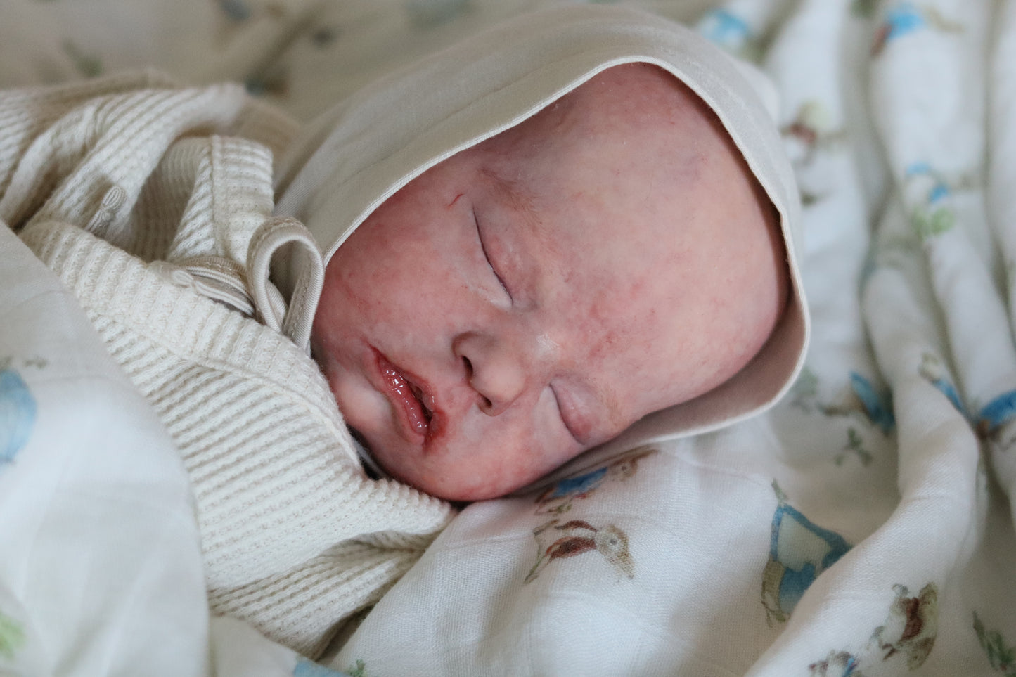 Mitchell, Partial Silicone by Bountiful Baby (Pre-Sale)