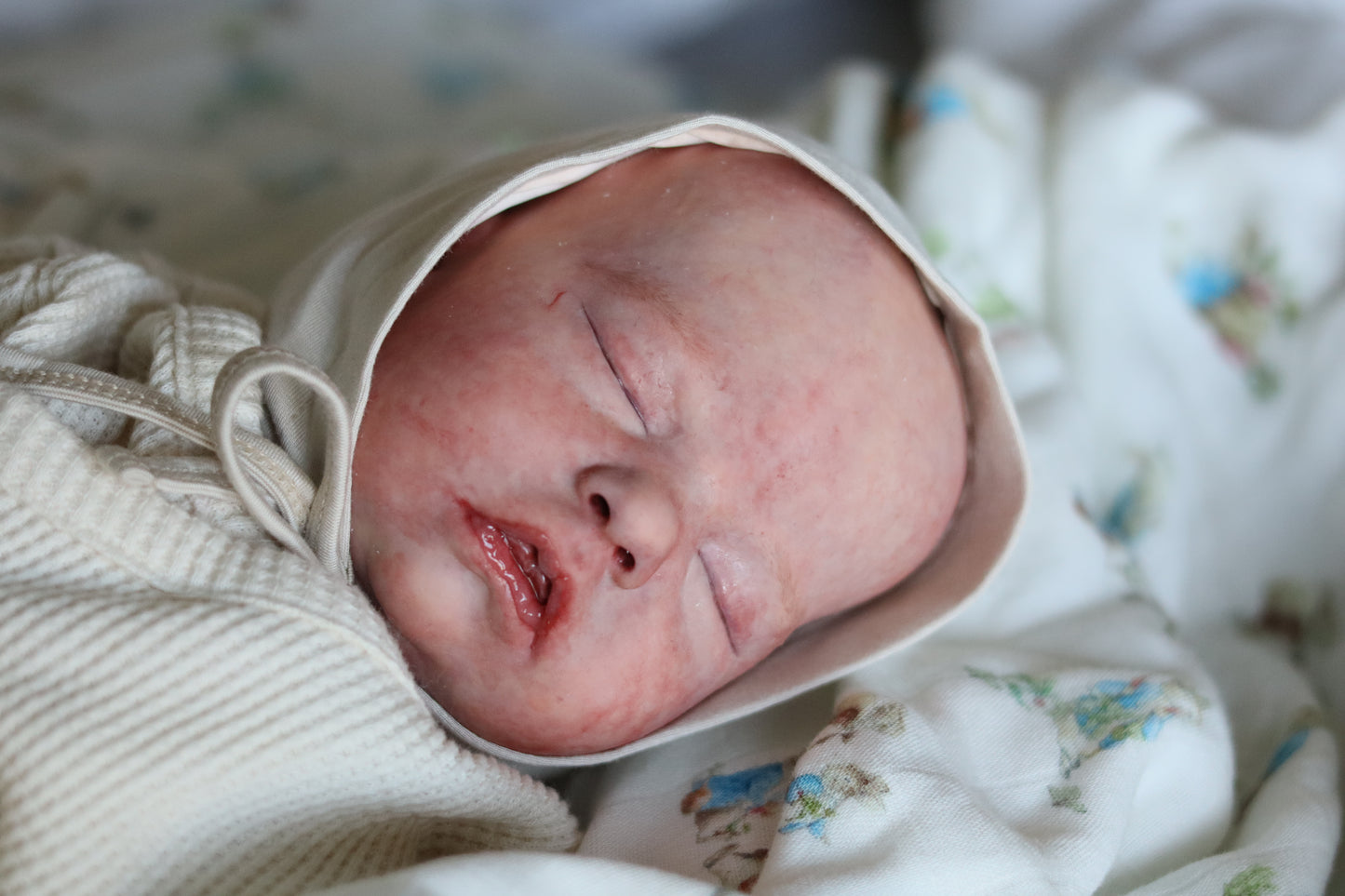 Mitchell, Partial Silicone by Bountiful Baby (Pre-Sale)