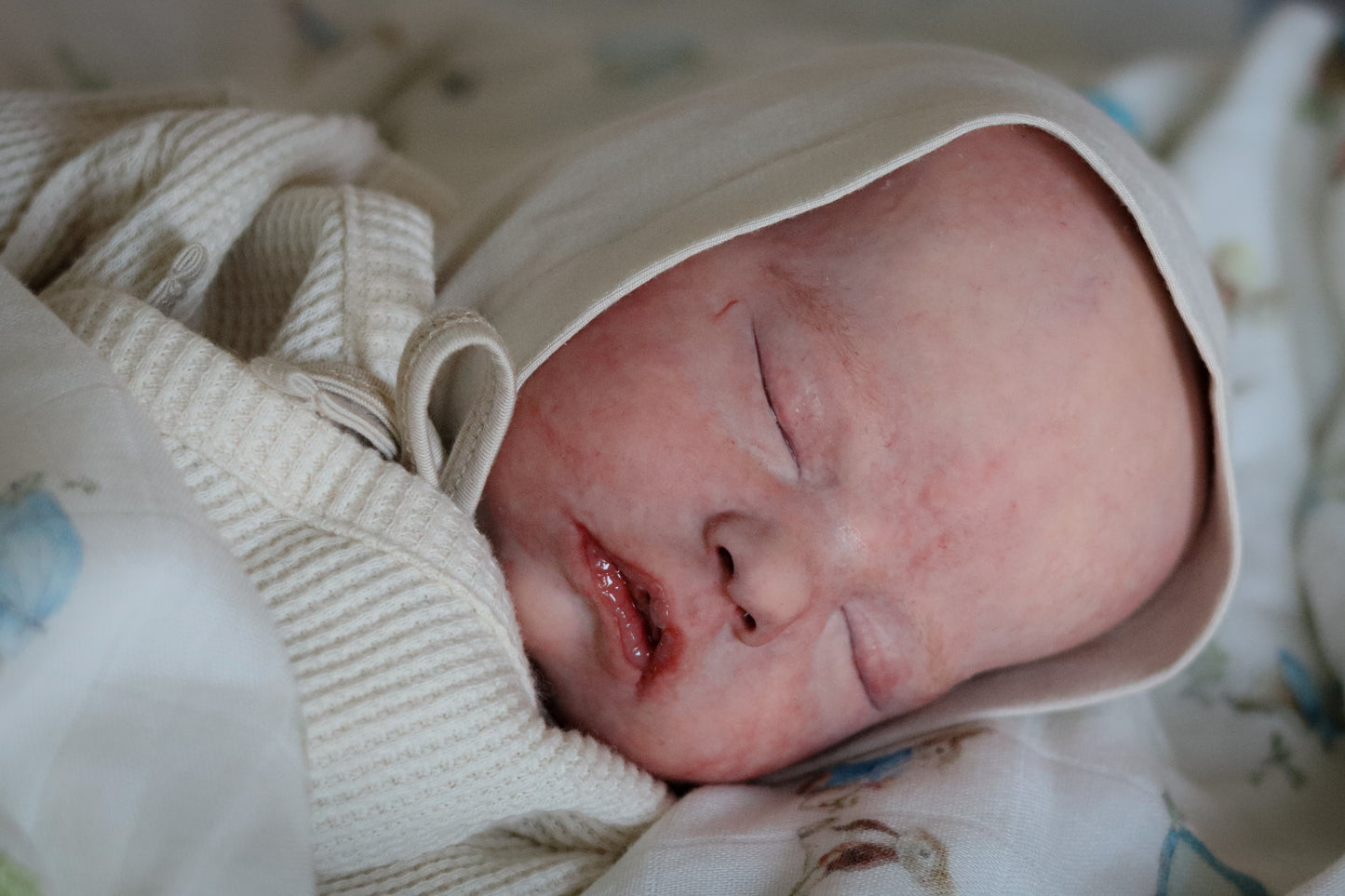 Mitchell, Partial Silicone by Bountiful Baby (Pre-Sale)